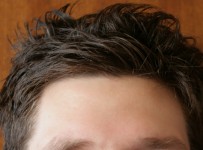 Forehead